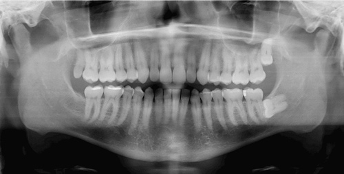 Dental-X-Ray.jpg